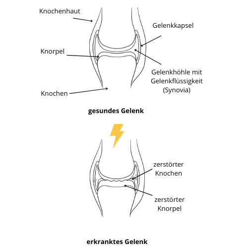 Gesundes und krankes Gelenk: Was passiert bei Arthrose beim Pferd?